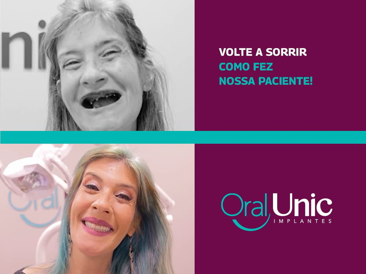 Depois — Resultado real